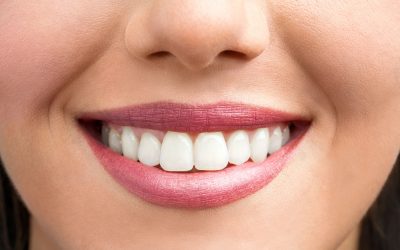 Front Teeth Crowns: What You Need to Know